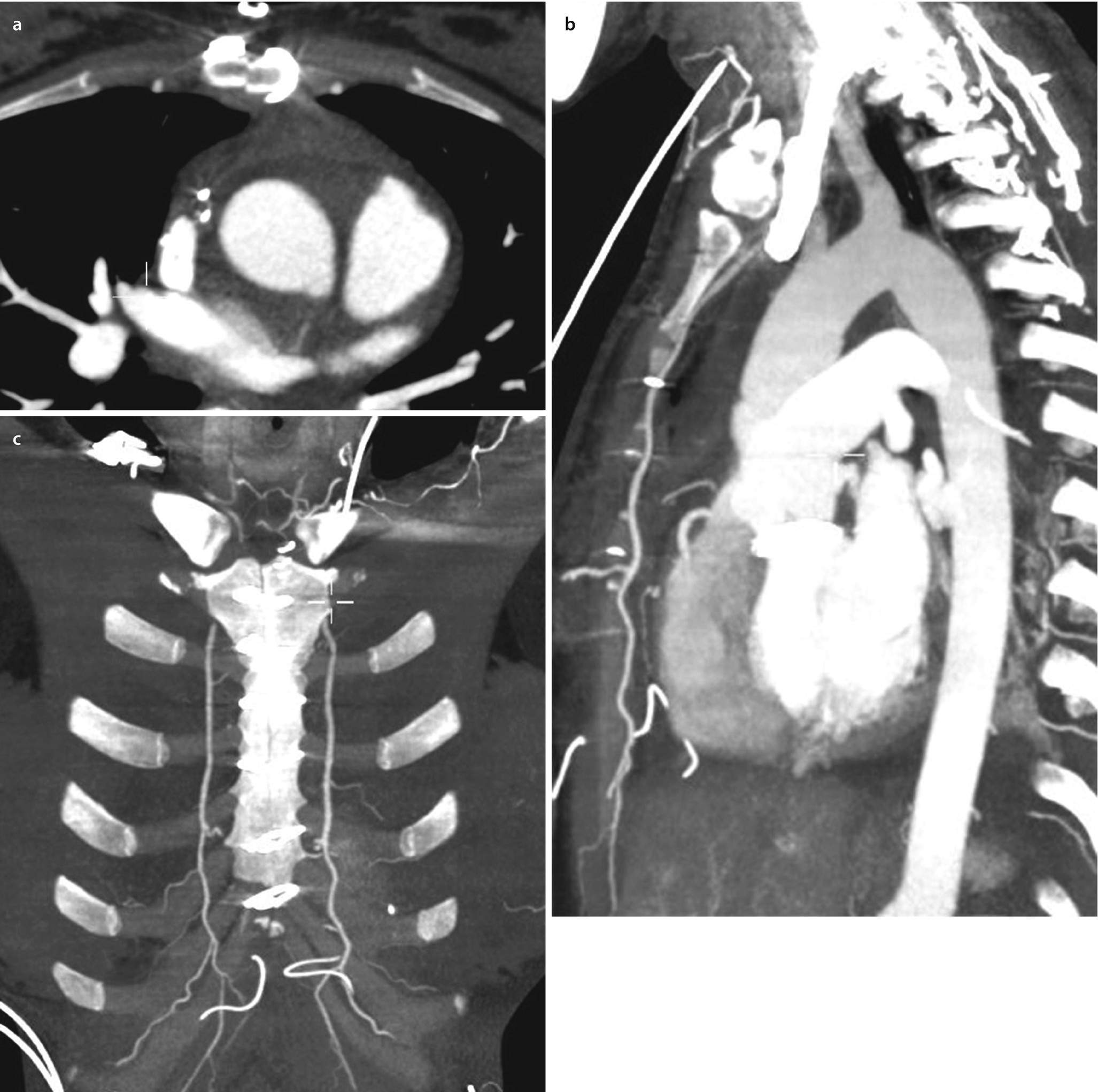 Bildgebende Radiologische Verfahren Springerlink