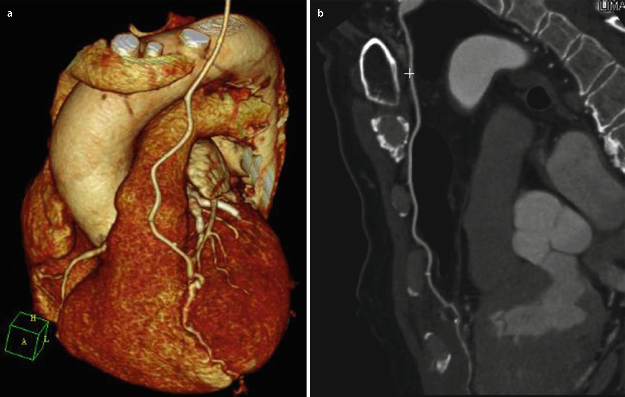 Bildgebende Radiologische Verfahren Springerlink