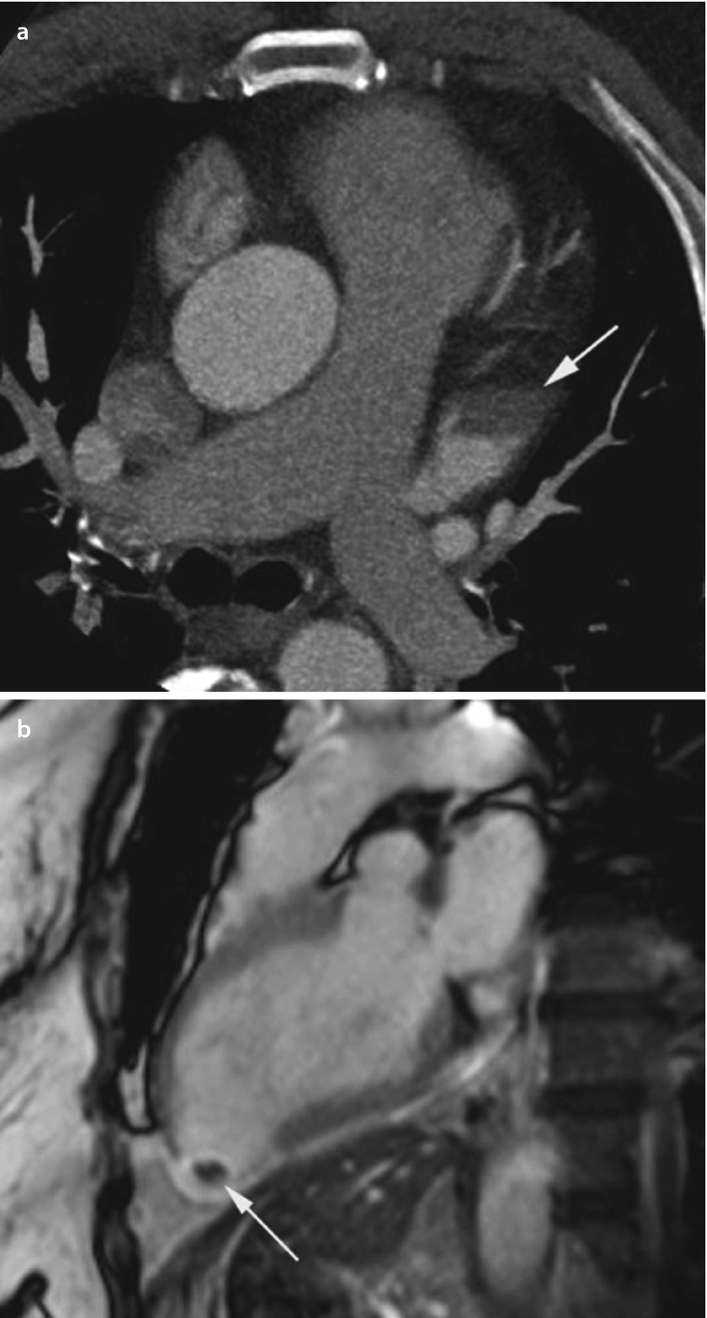 Bildgebende Radiologische Verfahren Springerlink