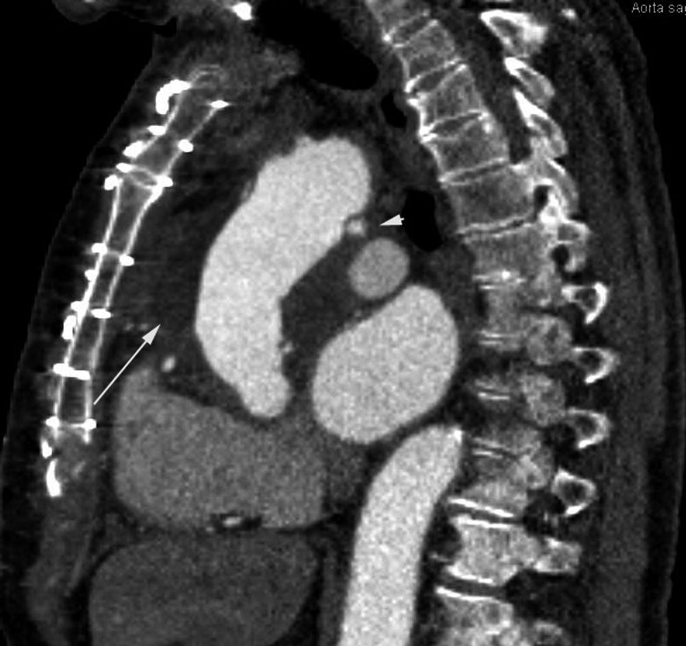 Bildgebende Radiologische Verfahren Springerlink