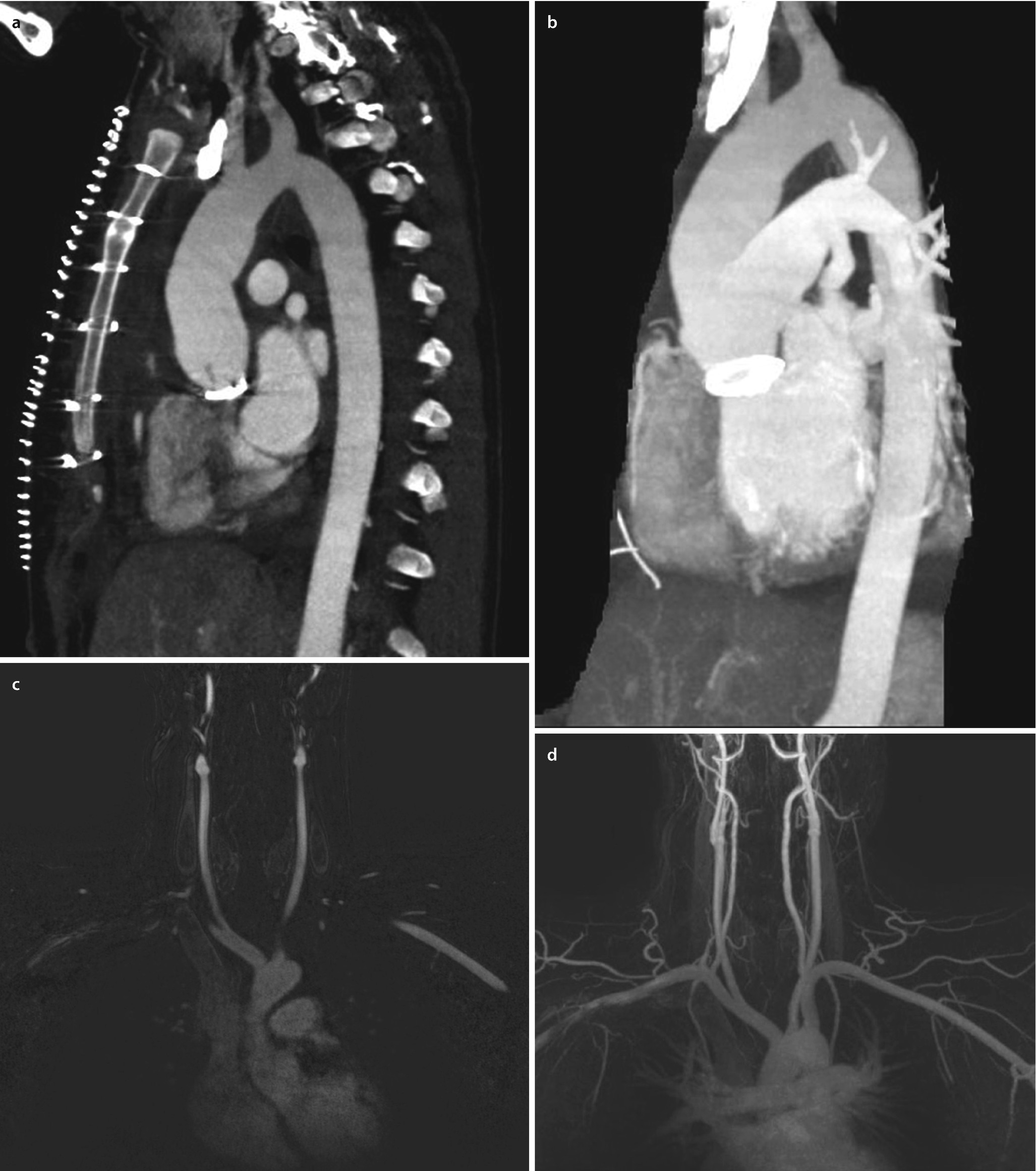 Bildgebende Radiologische Verfahren Springerlink