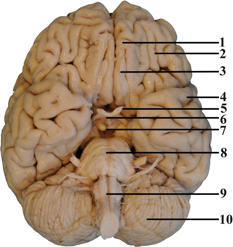 Gross Anatomy Of The Nervous System Springerlink