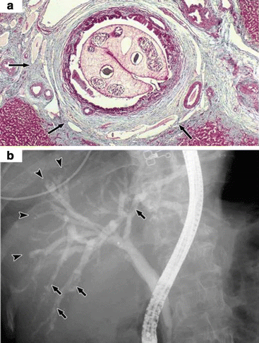 Clonorchiasis And Opisthorchiasis Springerlink