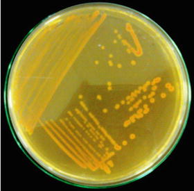 Secondary Metabolites of Pseudomonas aurantiaca and Their Role in Plant ...