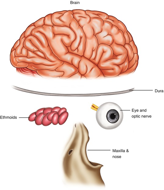 skull base tumors springerlink