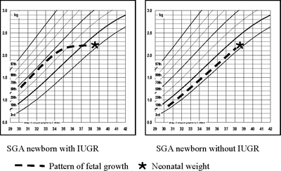 Intrauterine Growth Restriction Chart