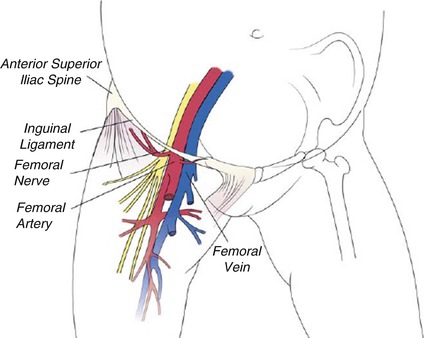 The Usual Vascular Access Springerlink The Usual Vascular Access Springerlink