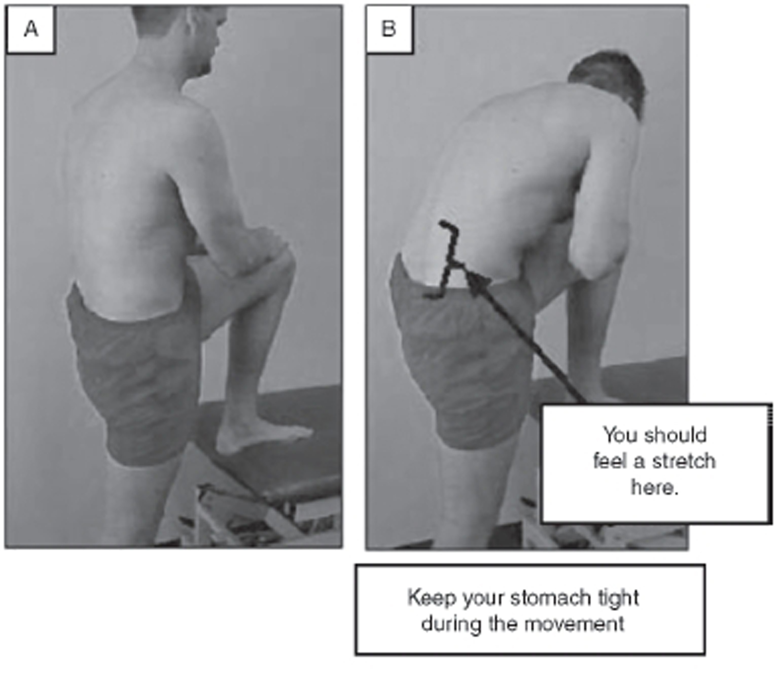 Manipulatie Van De Lumbosacrale Regio En Therapeutische Oefeningen Bij Een Patient Met Een Lumbosacrale Overgangswervel En Lagerugpijn Springerlink