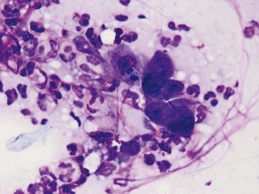 35 Virale Huidaandoeningen Springerlink