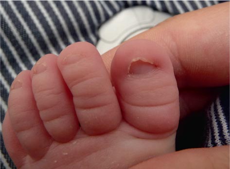 Anatomie En Fysiologie Van Het Nagelapparaat Springerlink