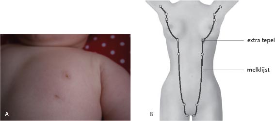 Extra Tepels Polythelia Springerlink