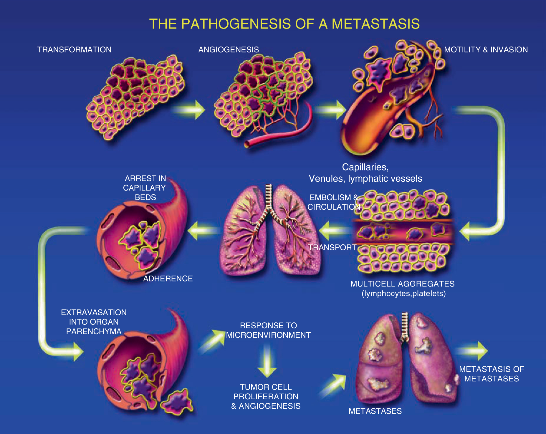 metastatic cancer define