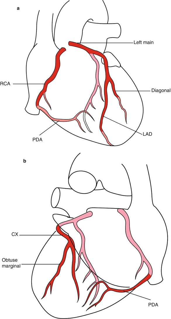 The Coronary Artery Springerlink