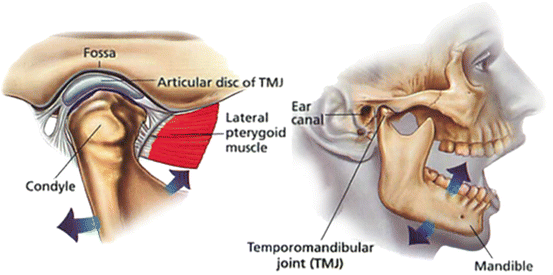 Tmj disorders thesis