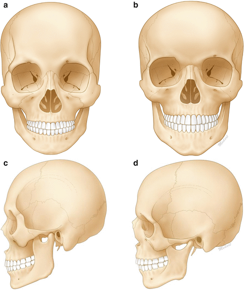 General Anatomy of the Face and Neck | SpringerLink