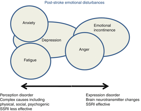 Post Stroke Management Emotional Disturbances And Pain Springerlink