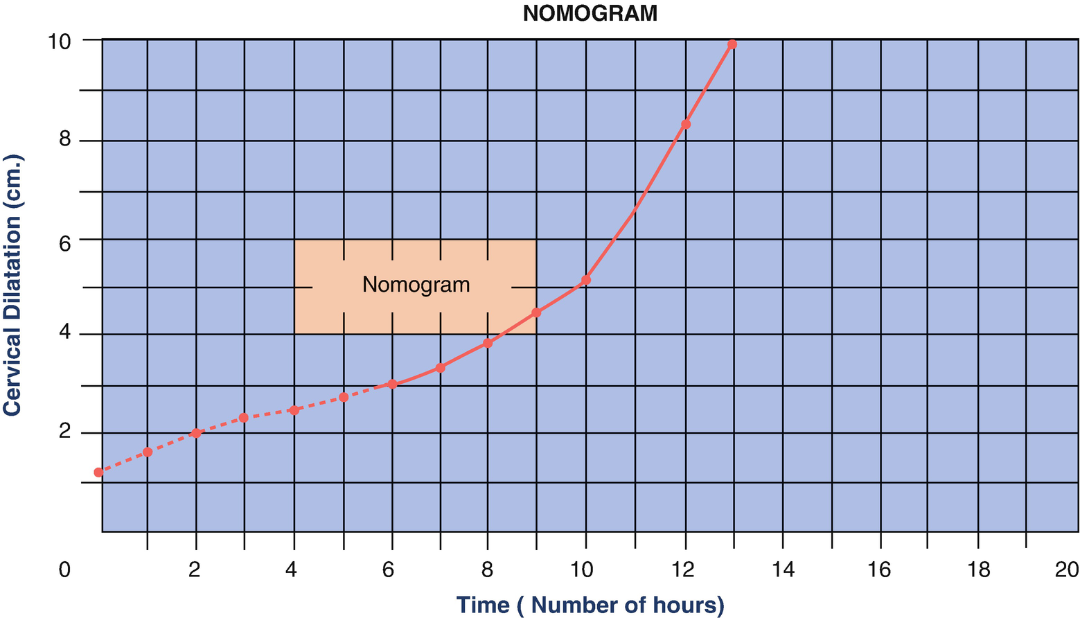 Augmentation And Management Of Labor Springerlink