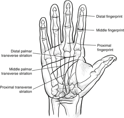 Functional Anatomy, Examination, and Functional Assessment of Hands ...