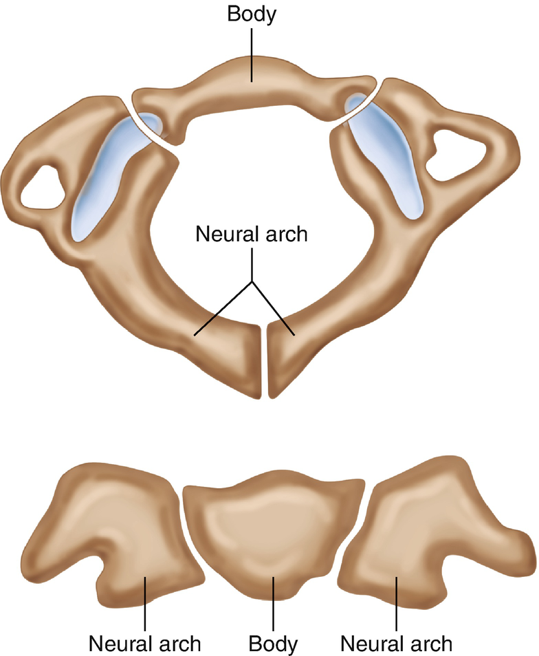 Spinal Cord Injury And Malformations In Children Springerlink