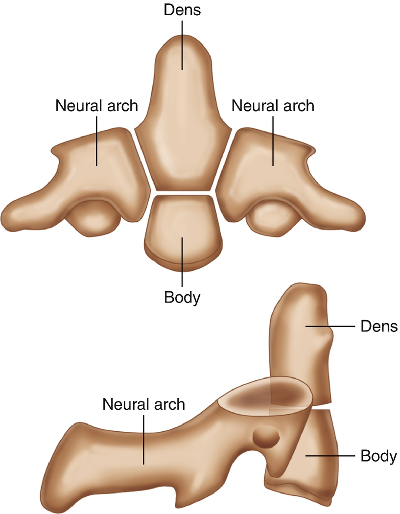 Spinal Cord Injury And Malformations In Children Springerlink