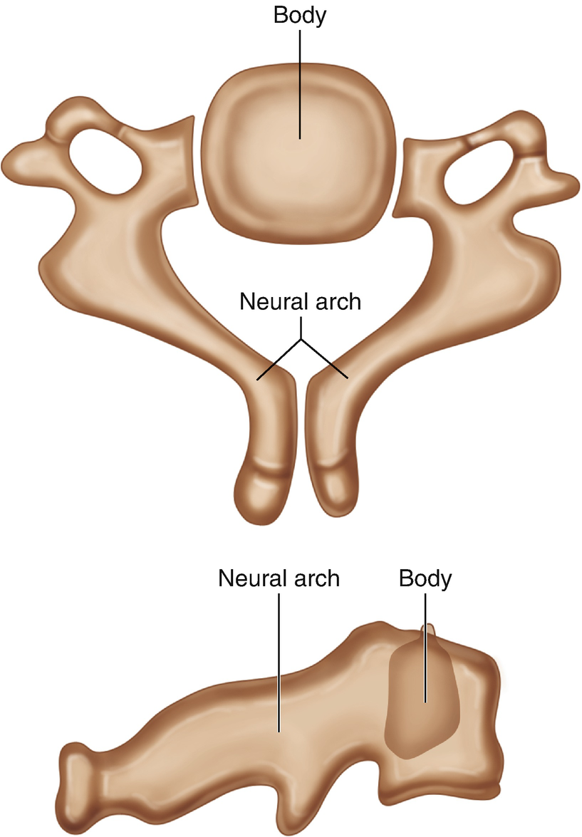 Spinal Cord Injury And Malformations In Children Springerlink