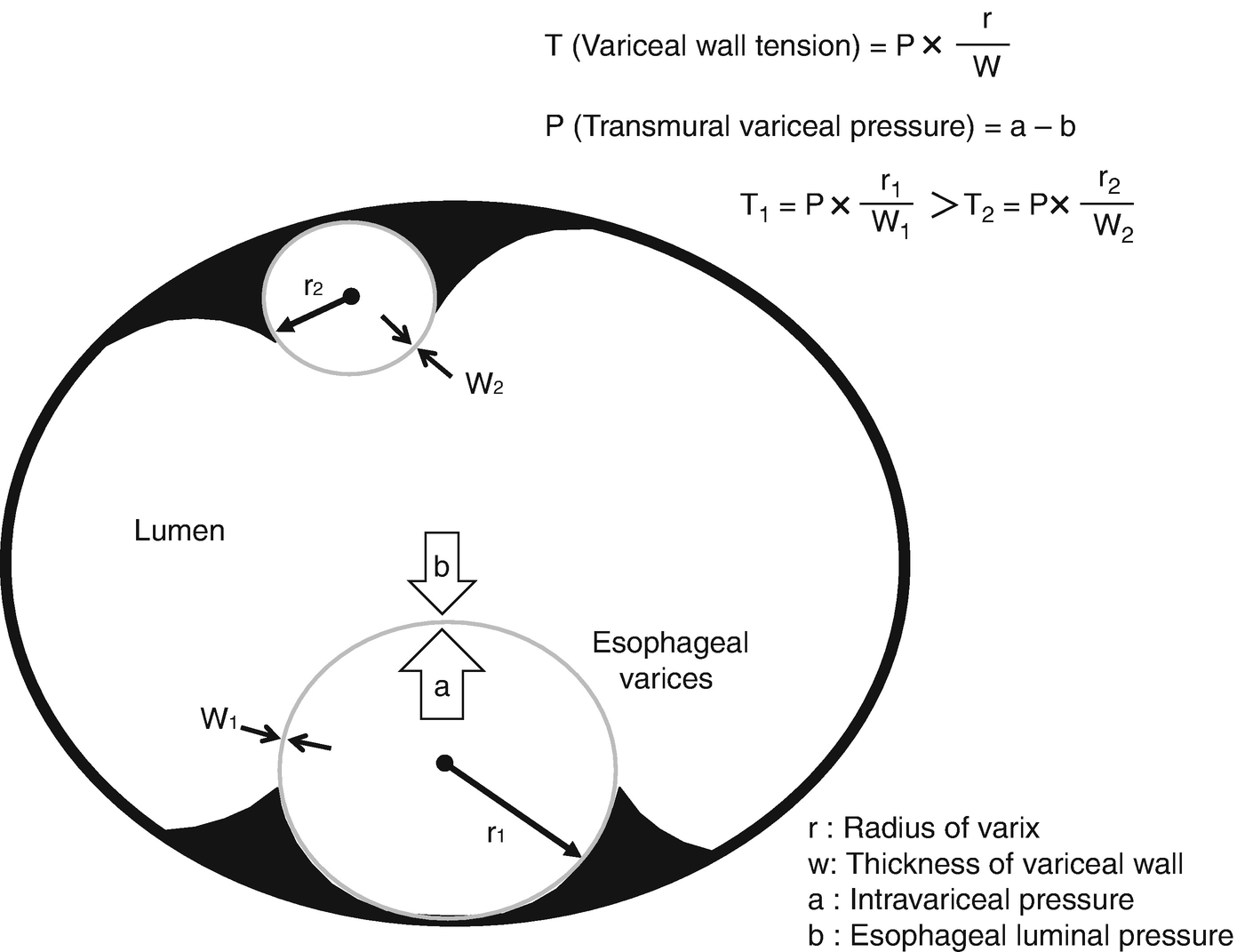 Mechanism and Pathophysiology of Bleeding from Esophagogastric 