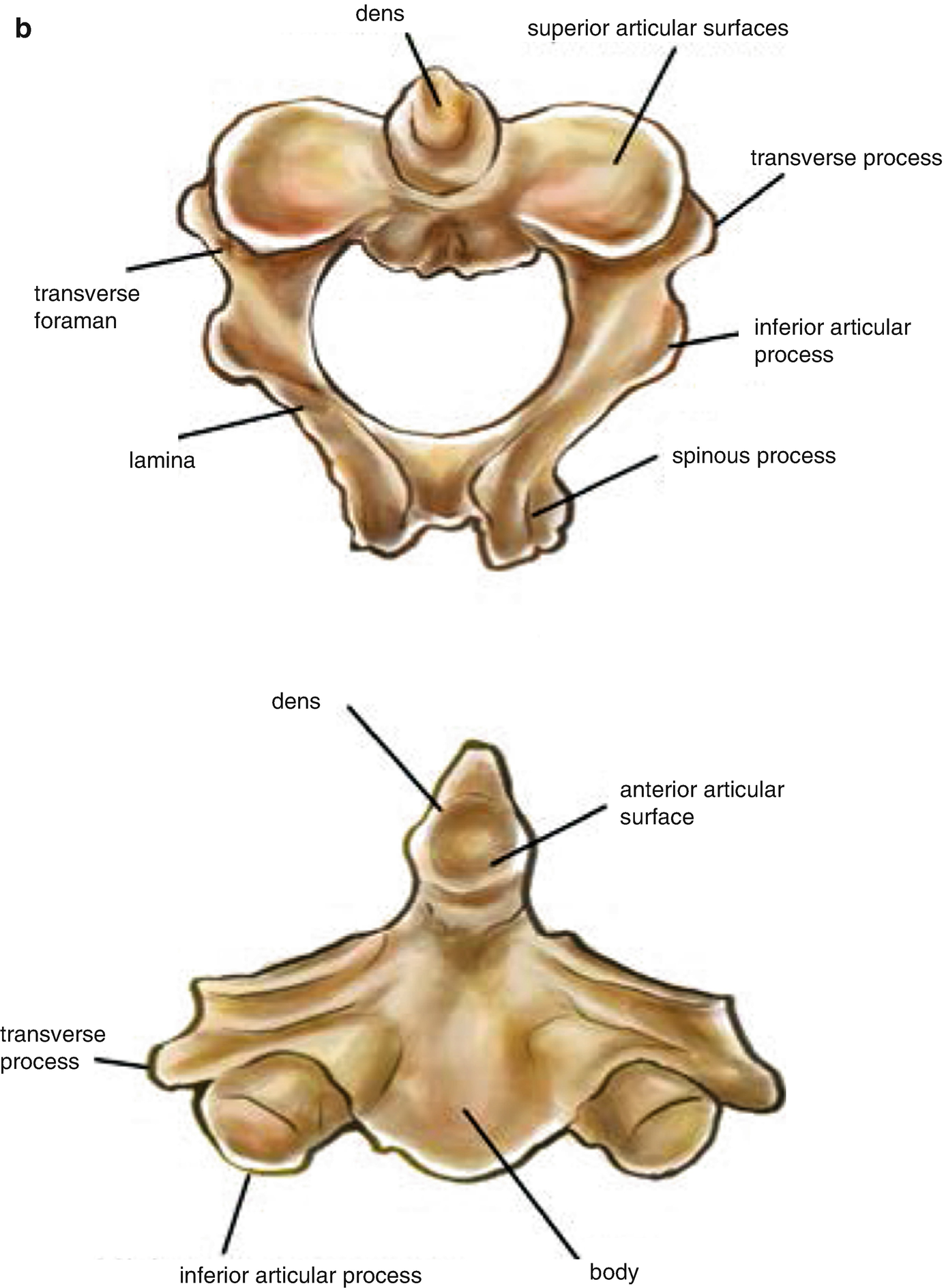 atlanto occipital joint articulation)