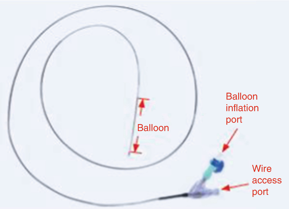 Balloon Dilatation Catheter SpringerLink