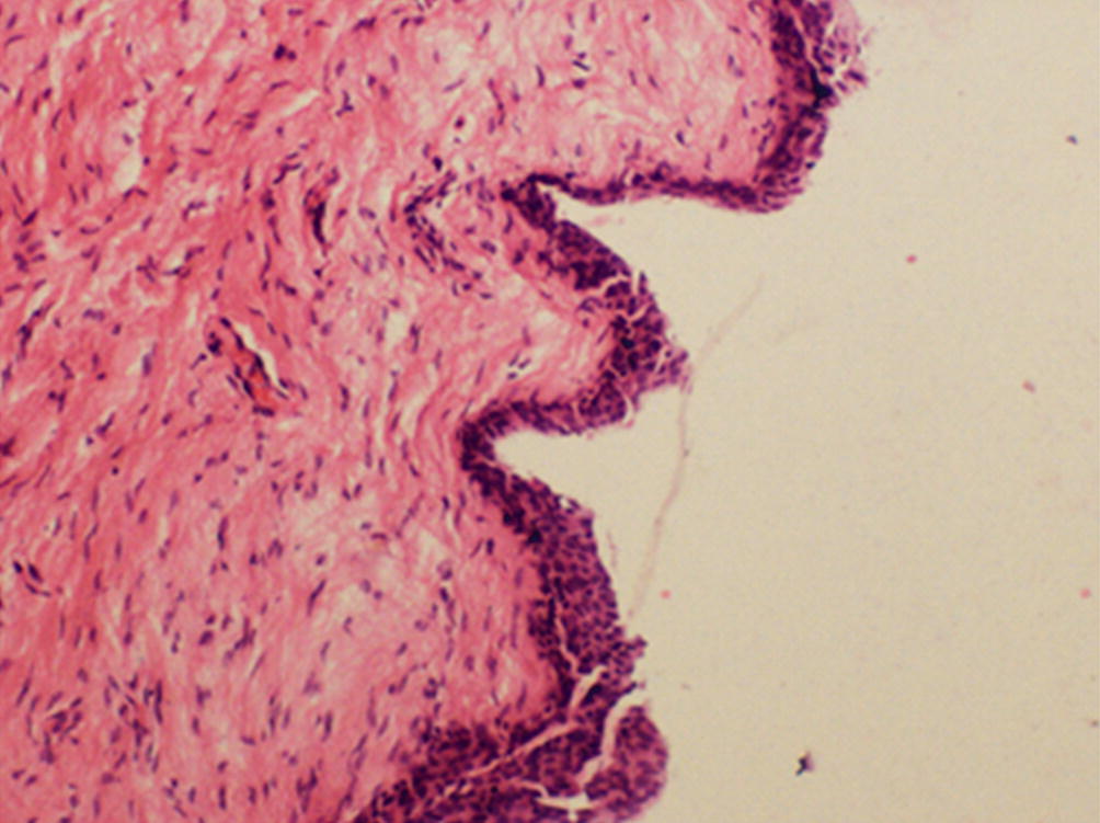 Pathology Of Vulva Springerlink