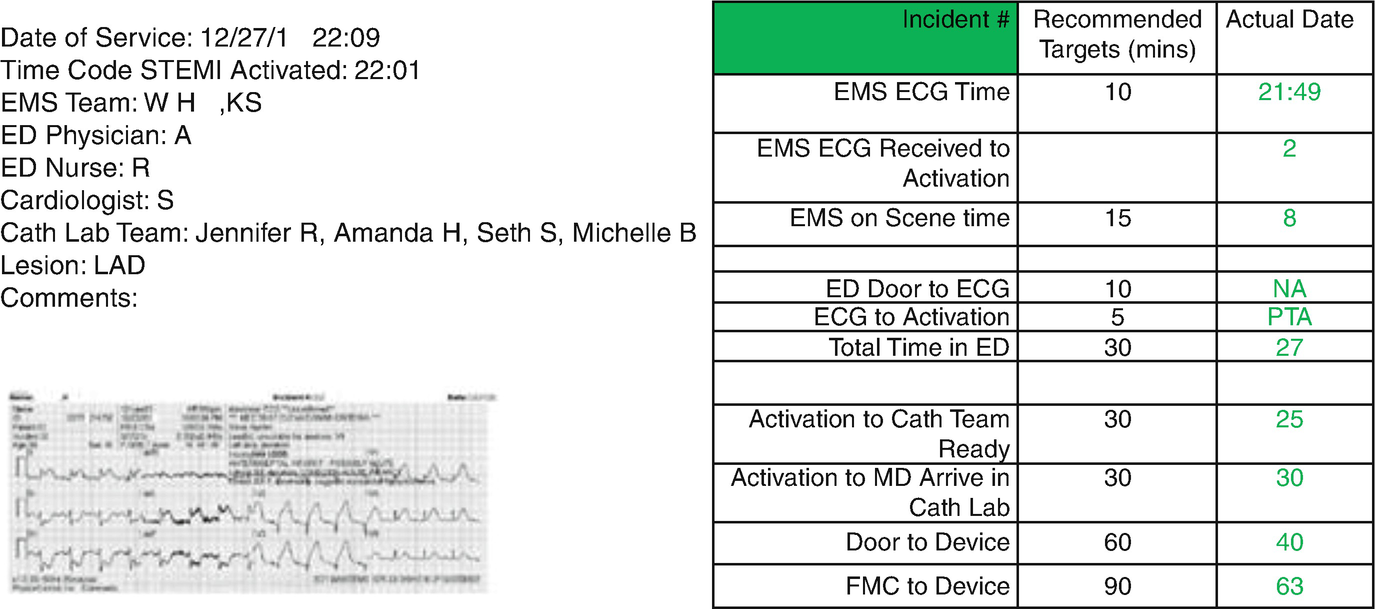 Time To Reperfusion Door To Balloon Times And How To Reduce Them