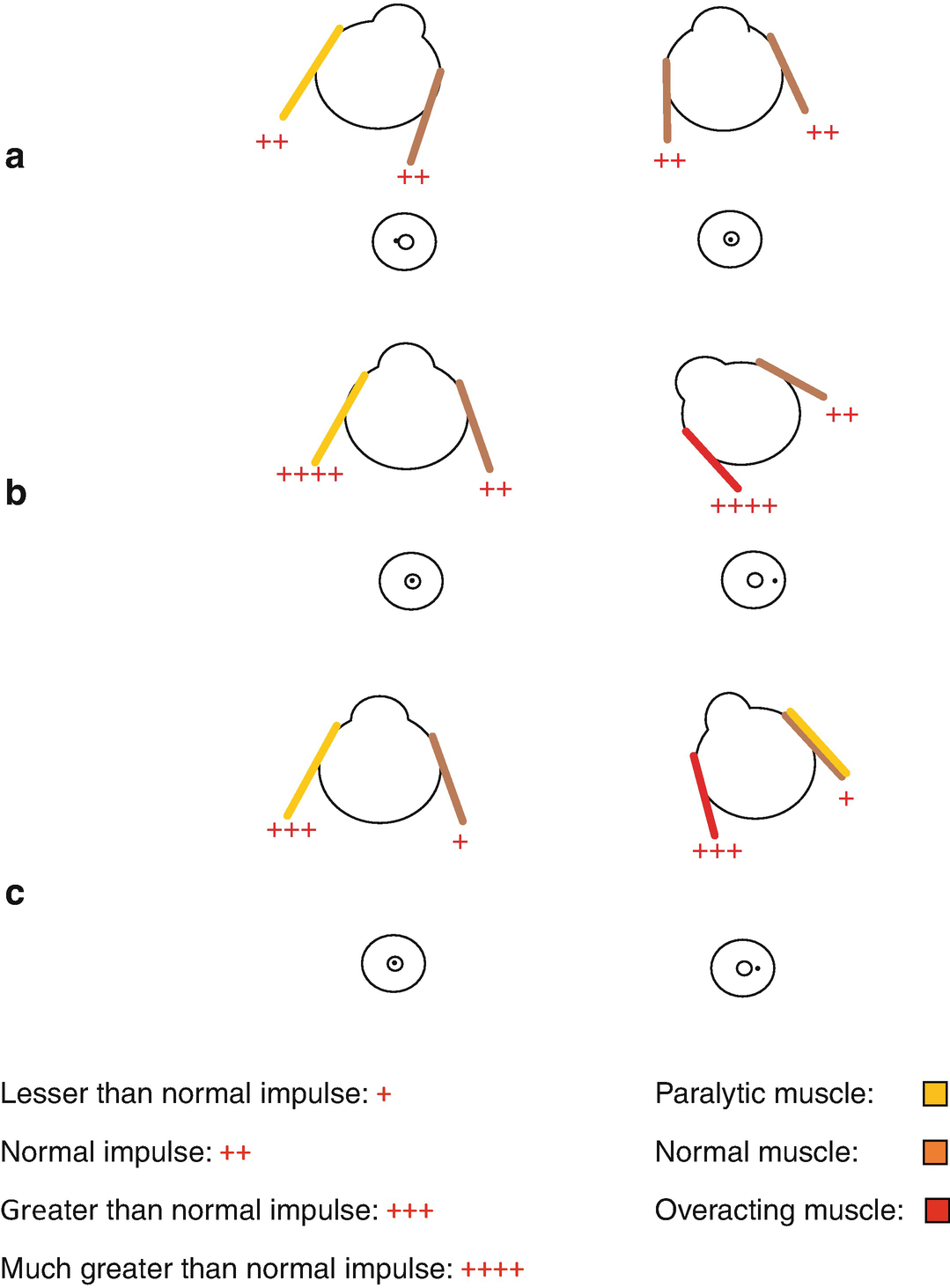 Diplopia Charting