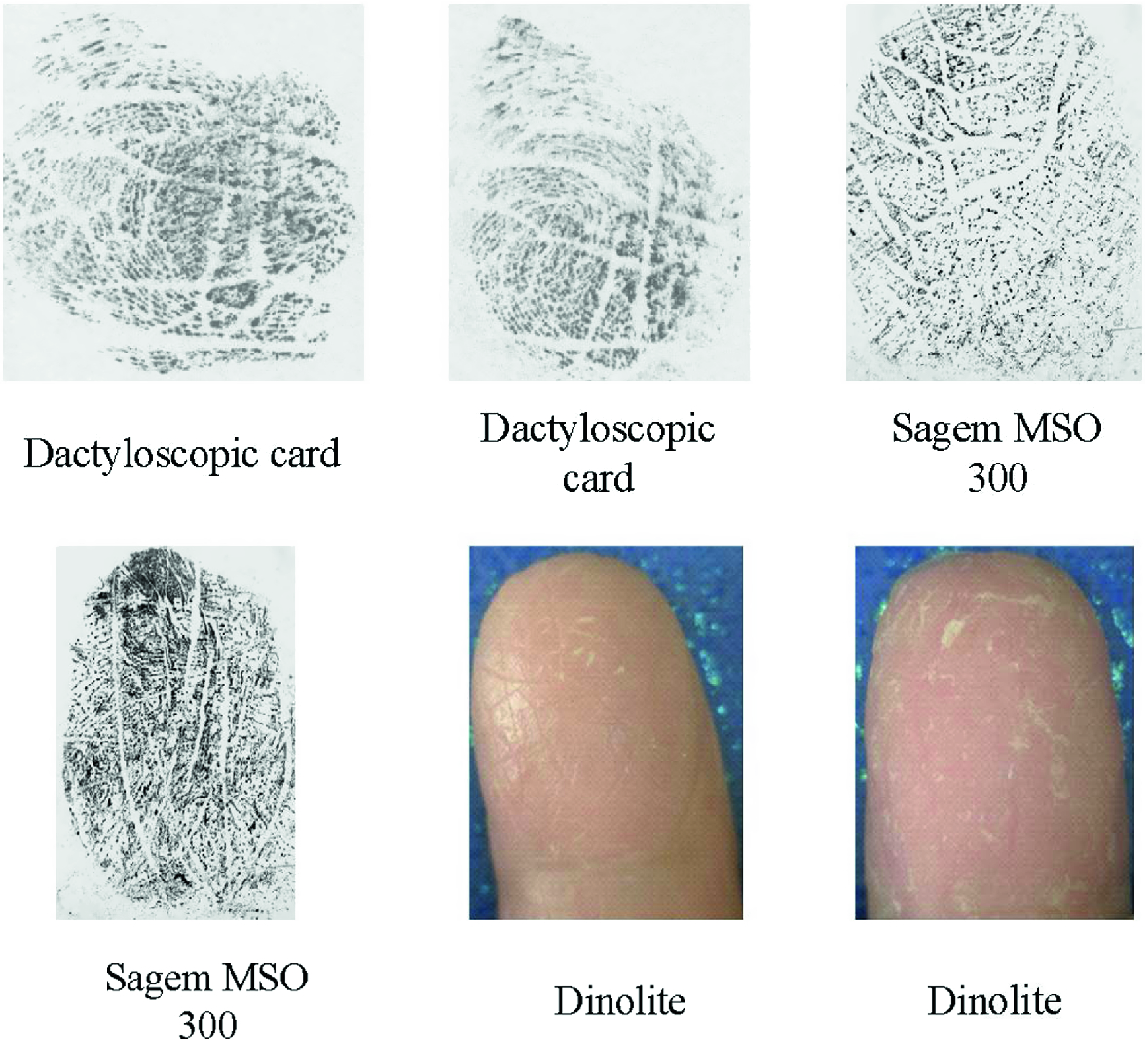 Influence Of Skin Diseases On Fingerprints Springerlink