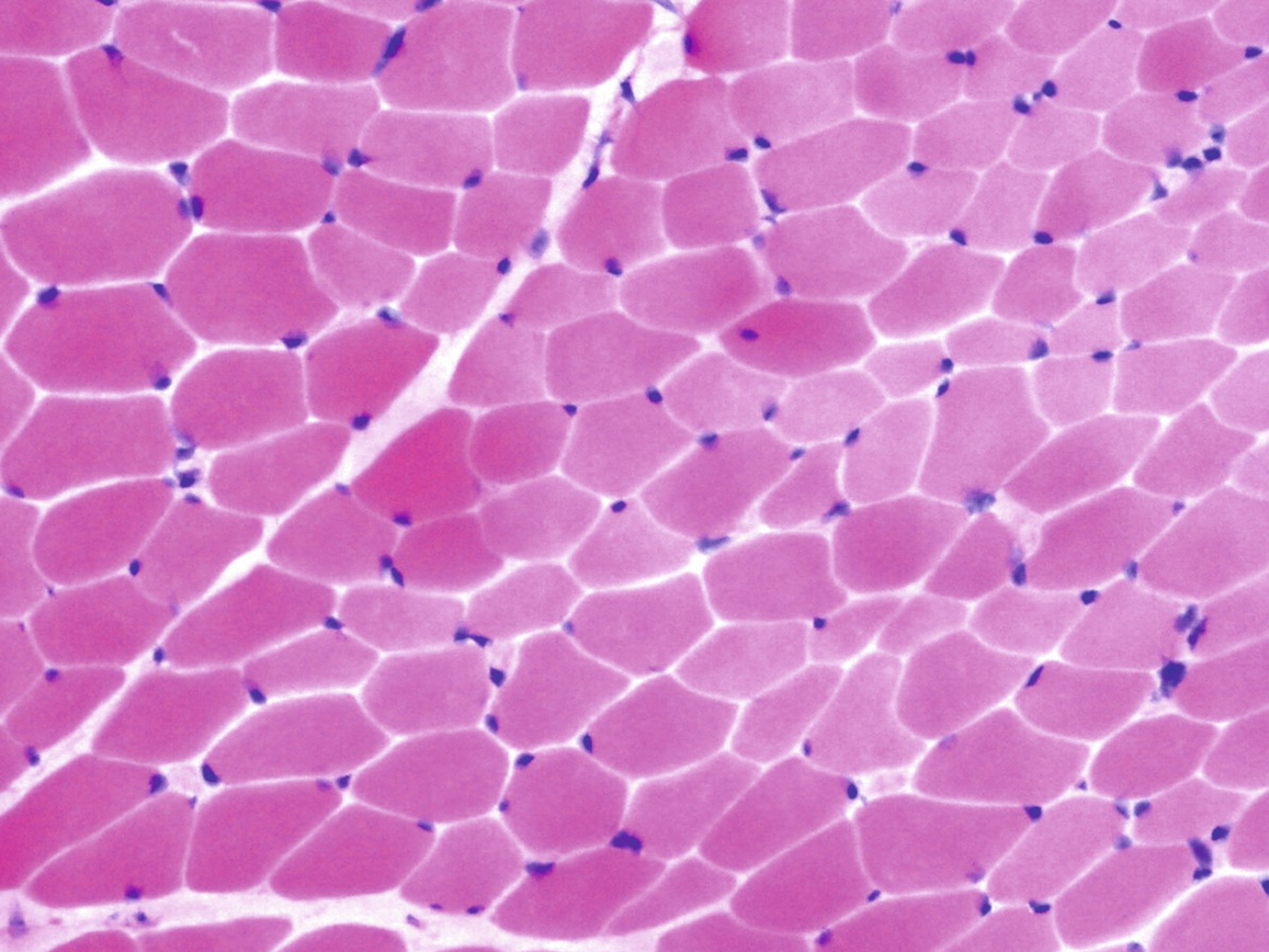 Introduction To Normal Skeletal Muscle Anatomy Physiology Histology And Ultrastructure Springerlink