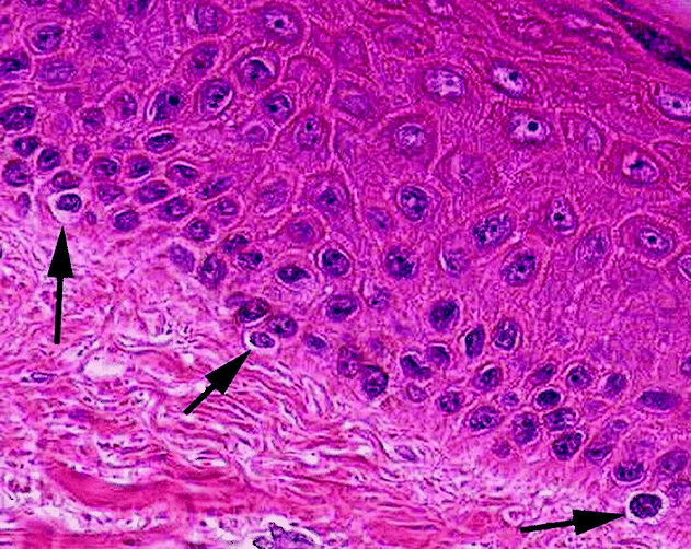 Development The Technique For The Preparation And Characterization Of Reconstructed Human Epidermis Rhe Springerlink
