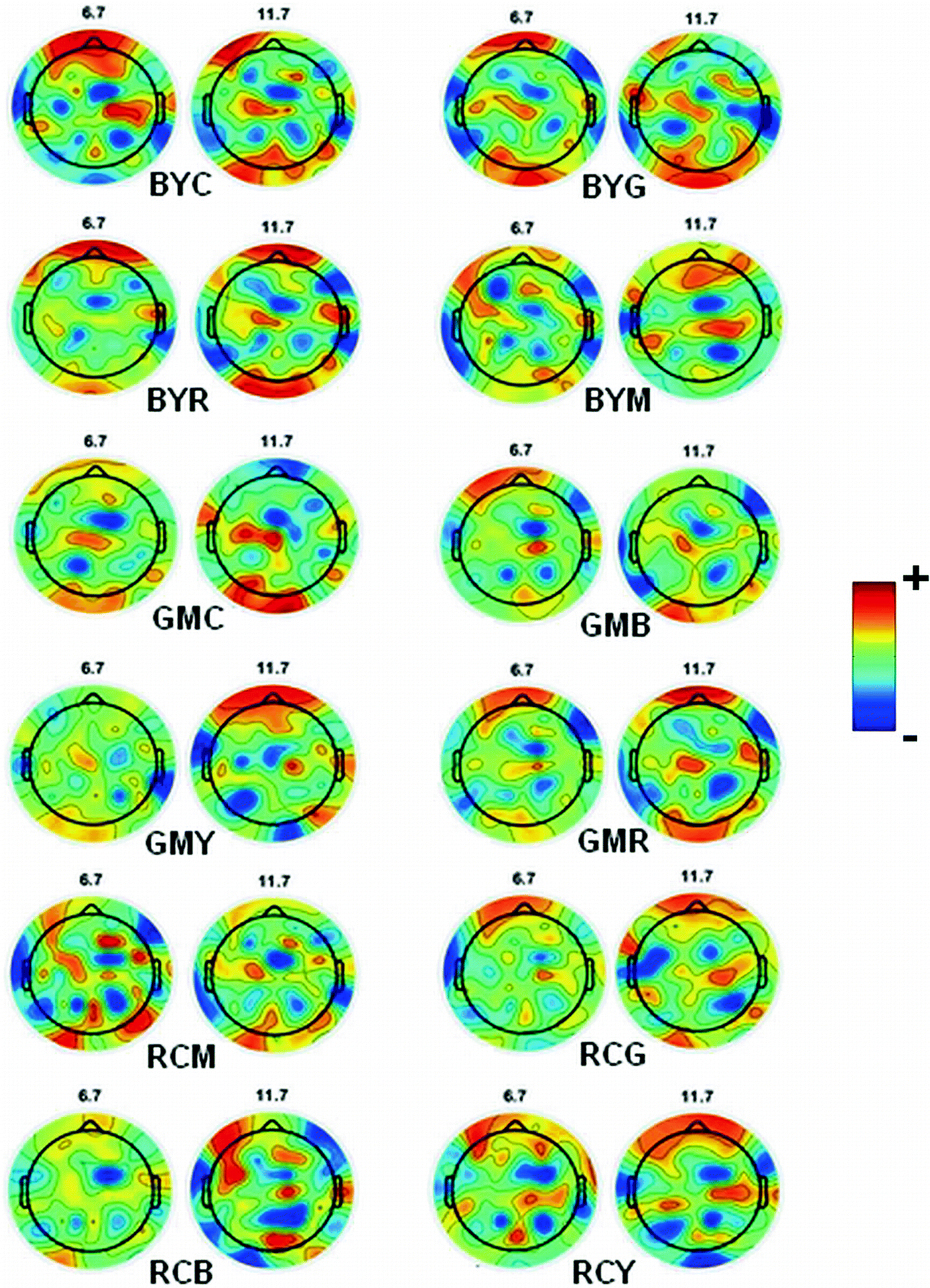 Analysis Of Complementary Colors Through Brain Response And Human