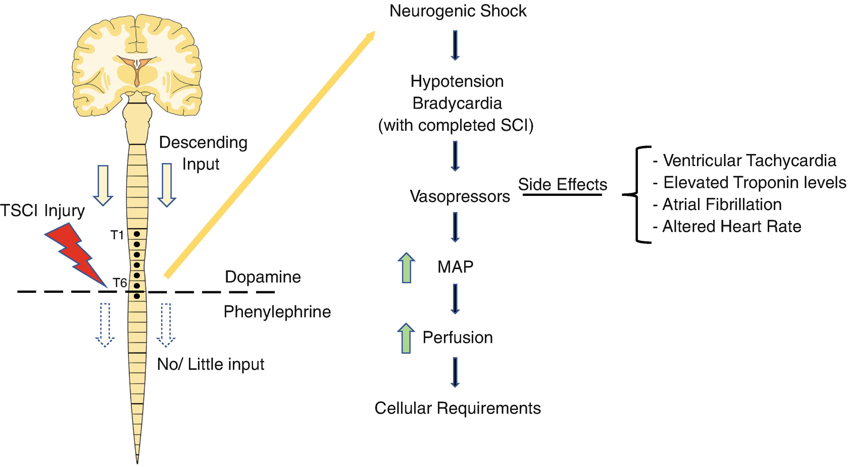 Anesthesia for Traumatic Spine Injury | SpringerLink Anesthesia for Traumatic Spine Injury | SpringerLink