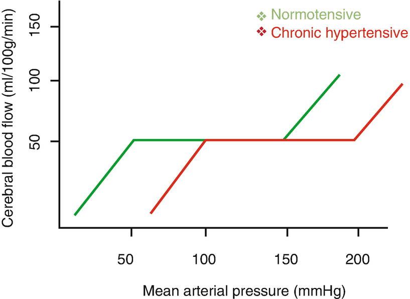 Co Existing Hypertension In Neurosurgery Springerlink