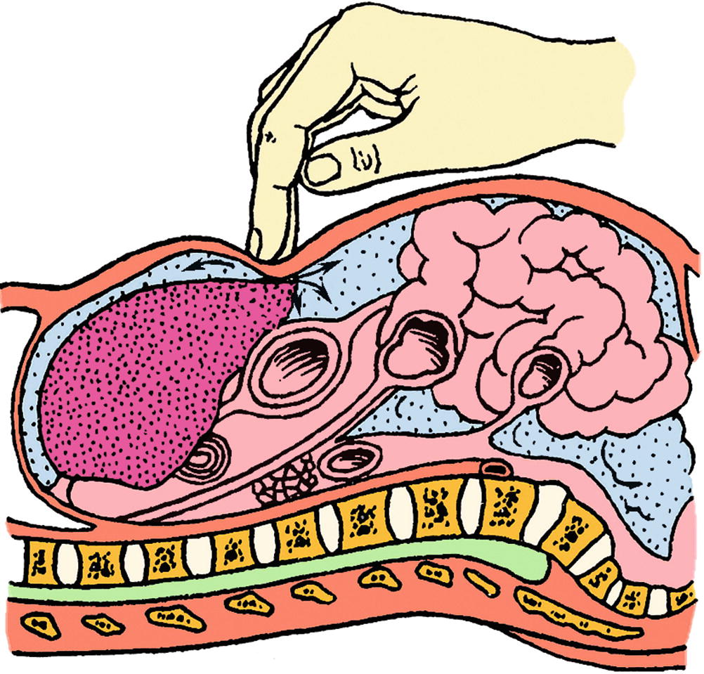 Basic Skills Of Physical Examination Springerlink