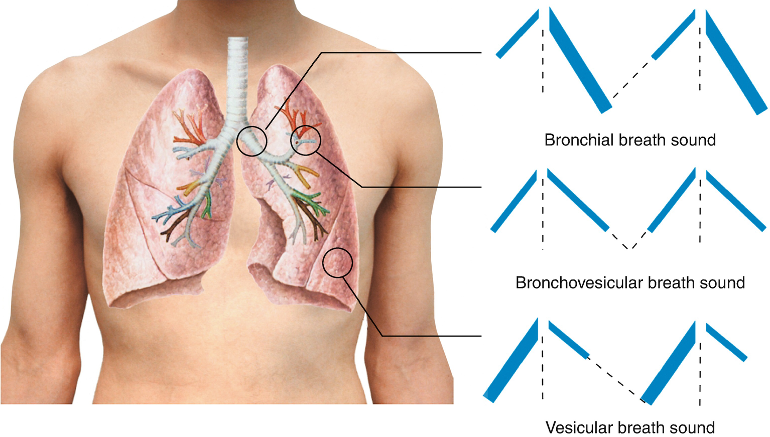 Physical Examination Of Chest Springerlink