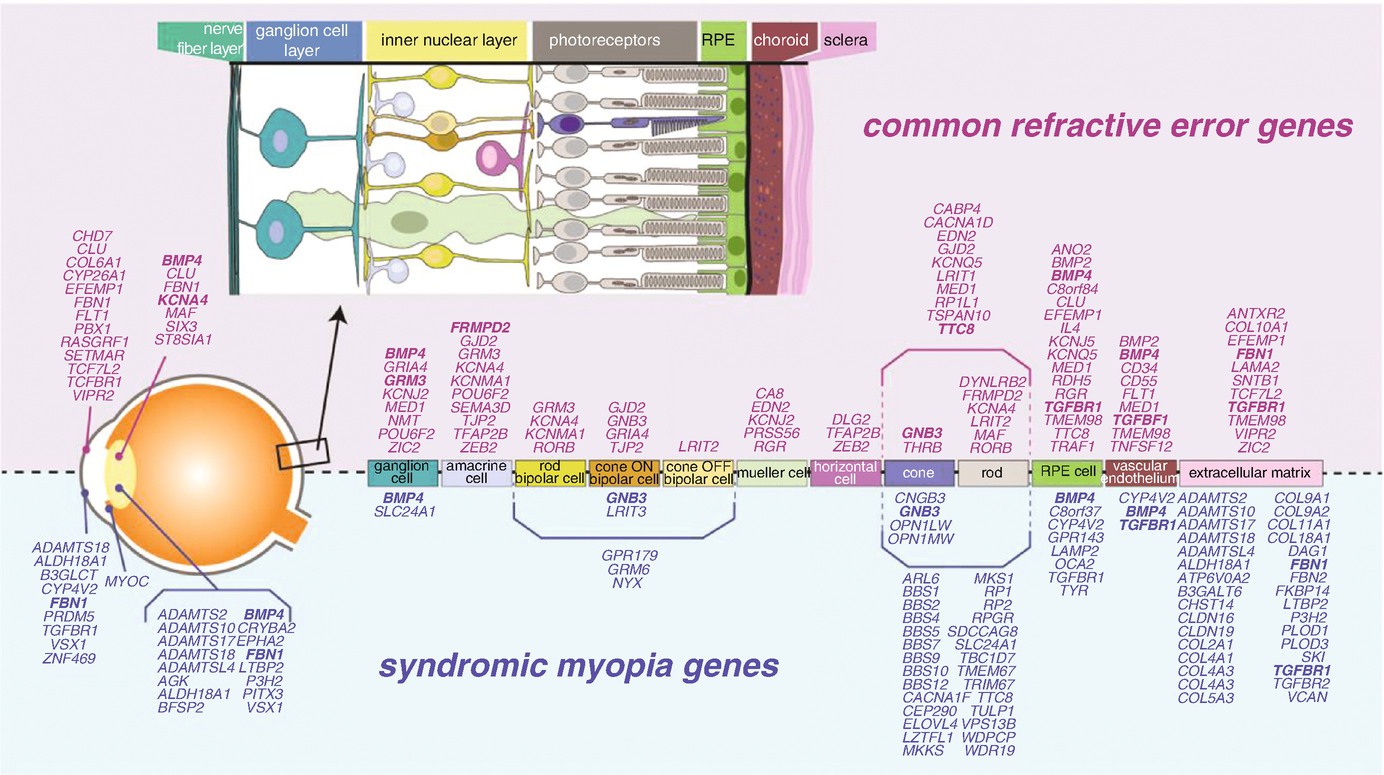 myopia domináns gén