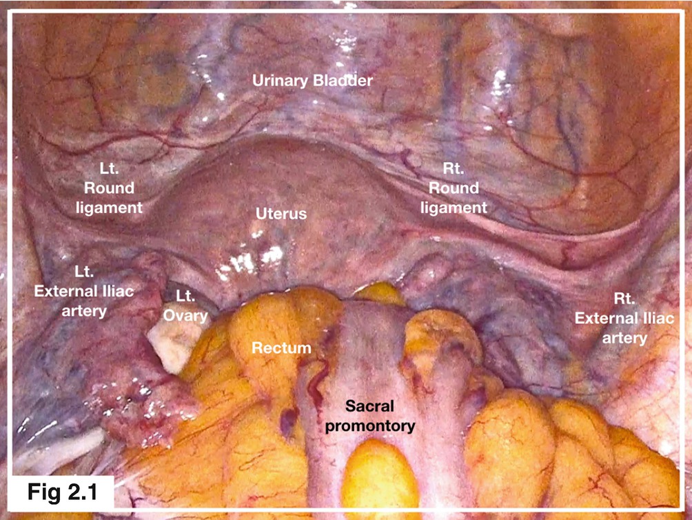 Pelvis Boundaries Springerlink