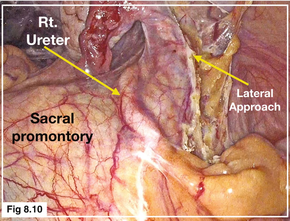 Anatomy Of The Ureter Springerlink