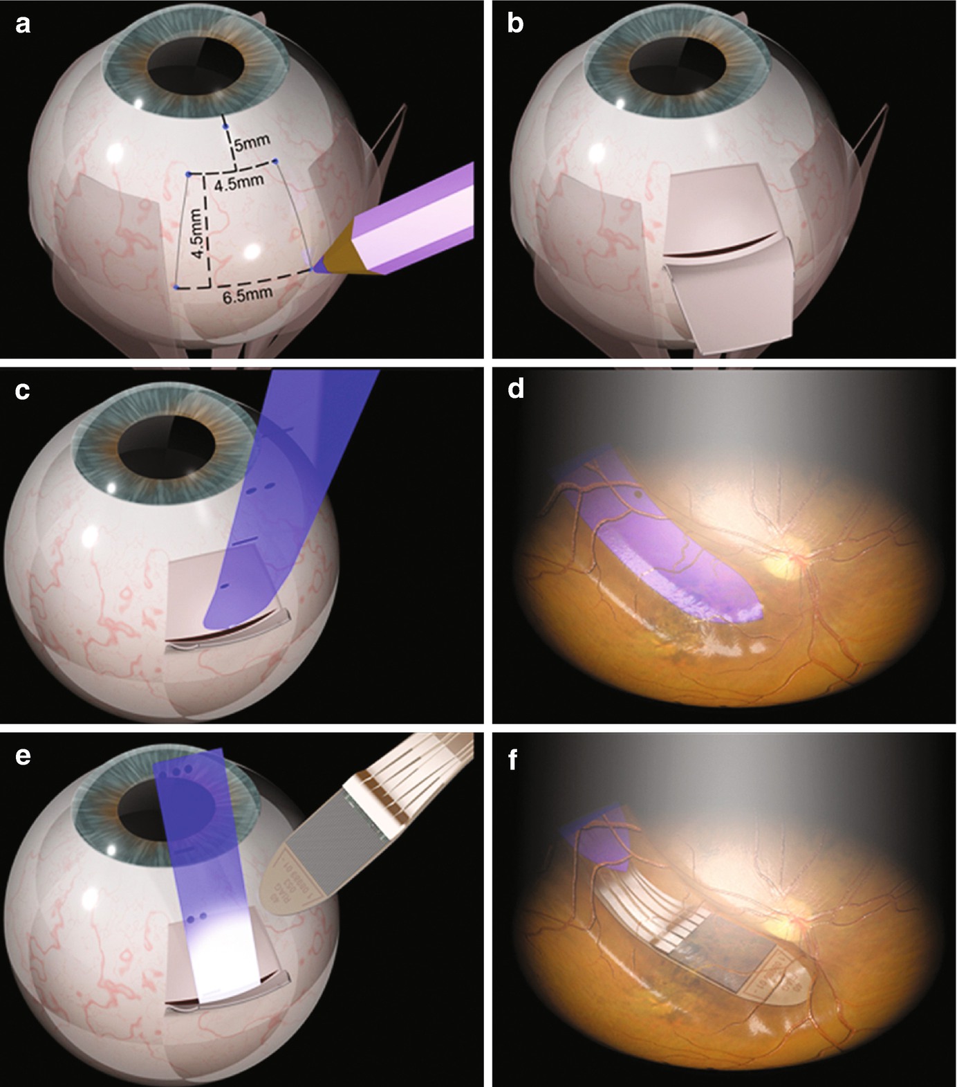 Immagini Natalizie 192 Pixel.Newer Techniques In Vision Restoration And Rehabilitation Springerlink