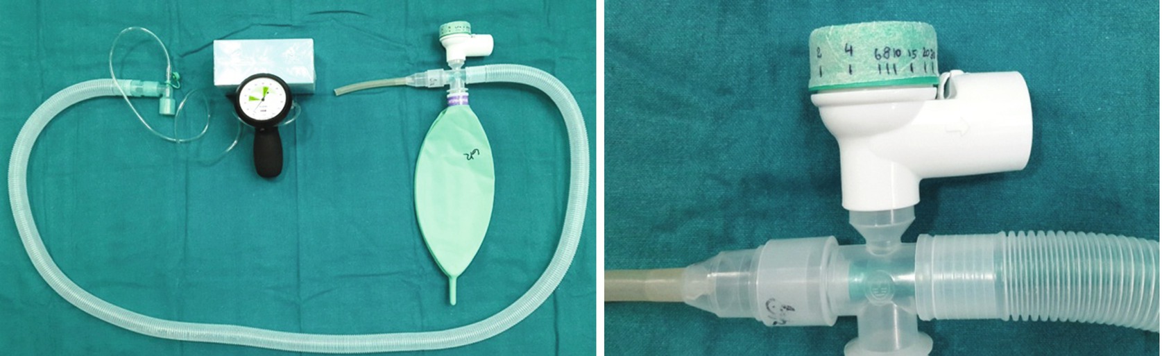 Thoracic Anesthesia Equipment Springerlink