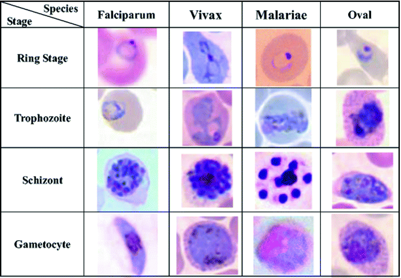 Кровь на малярию. Плазмодий Vivax. Плазмодии малярии в мазке крови. Plasmodium falciparum строение. Плазмодий Вивакс морфология.