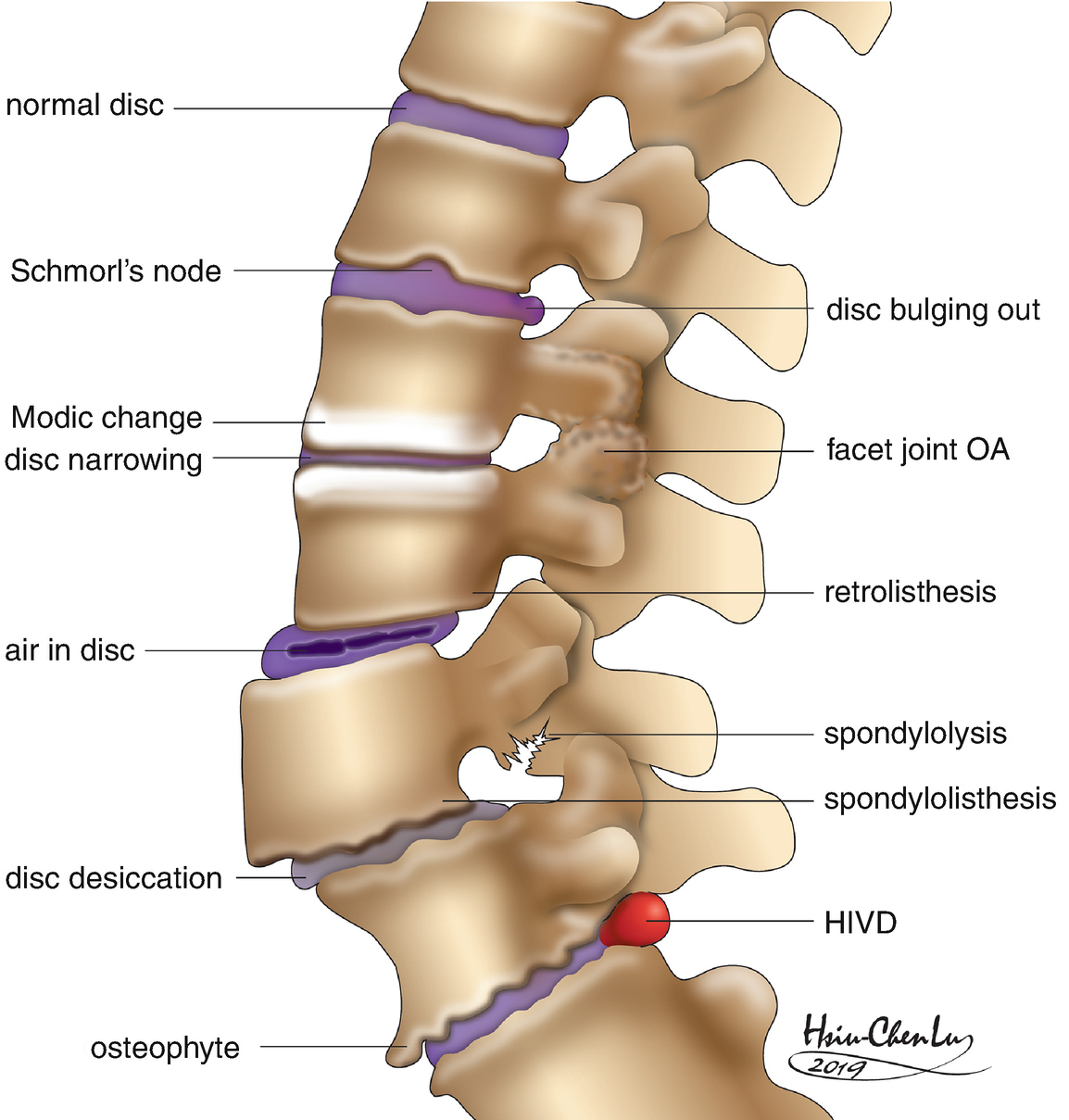 agent articular și spinal)