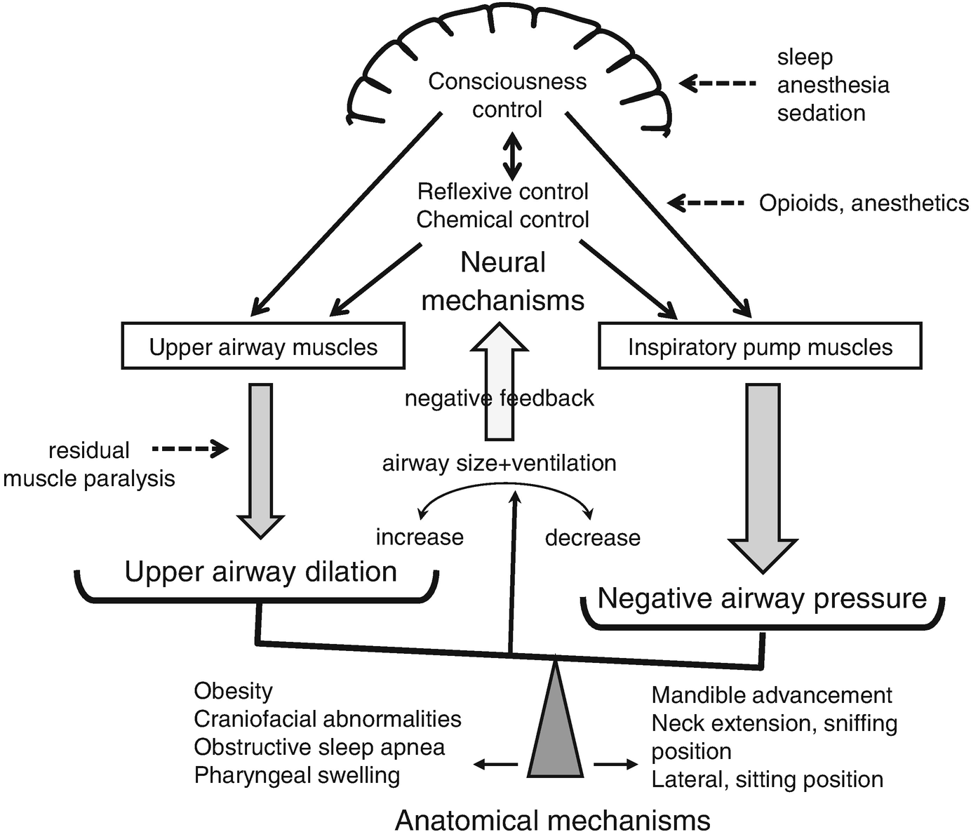 Instability of Upper Airway During Anesthesia and Sedation: How Is Upper Airway Unstable During Anesthesia and Sedation? | SpringerLink Instability of Upper Airway During Anesthesia and Sedation: How Is Upper Airway Unstable During Anesthesia and Sedation? | SpringerLink
