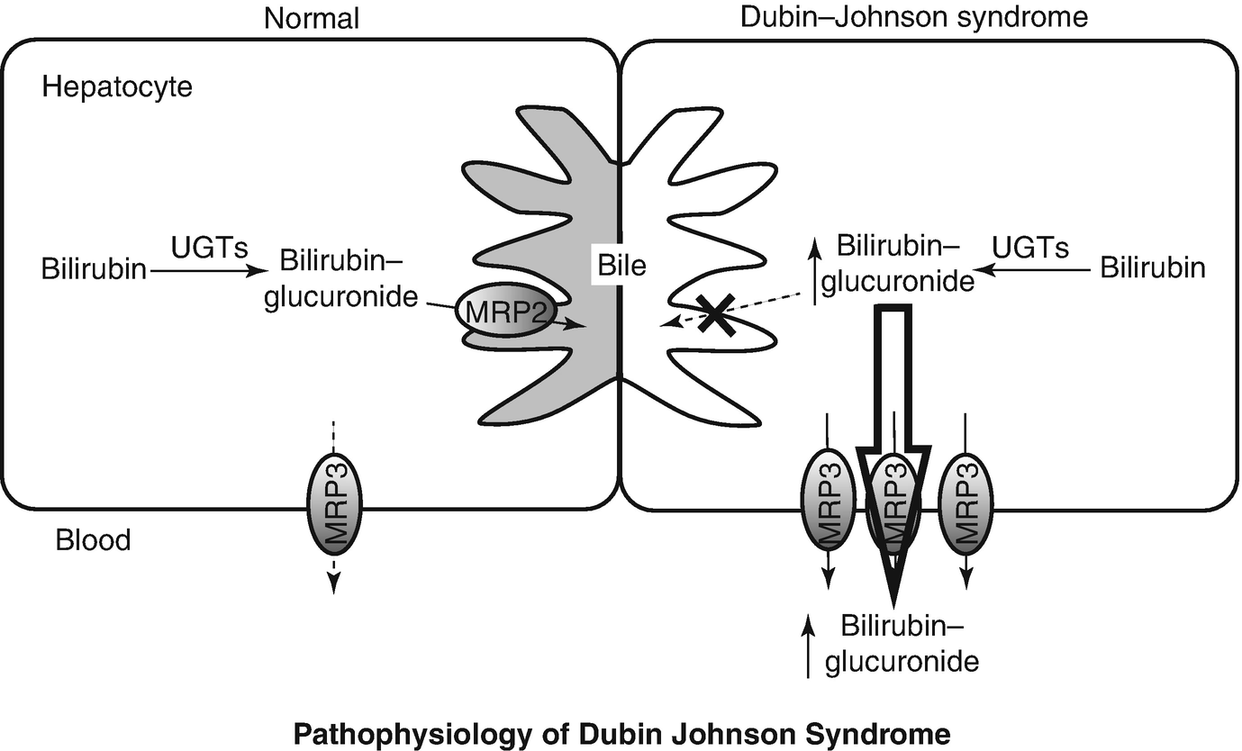 Case 19 A Pleasant Child Who Developed Prolonged Jaundice Springerlink Case 19 A Pleasant Child Who Developed Prolonged Jaundice Springerlink