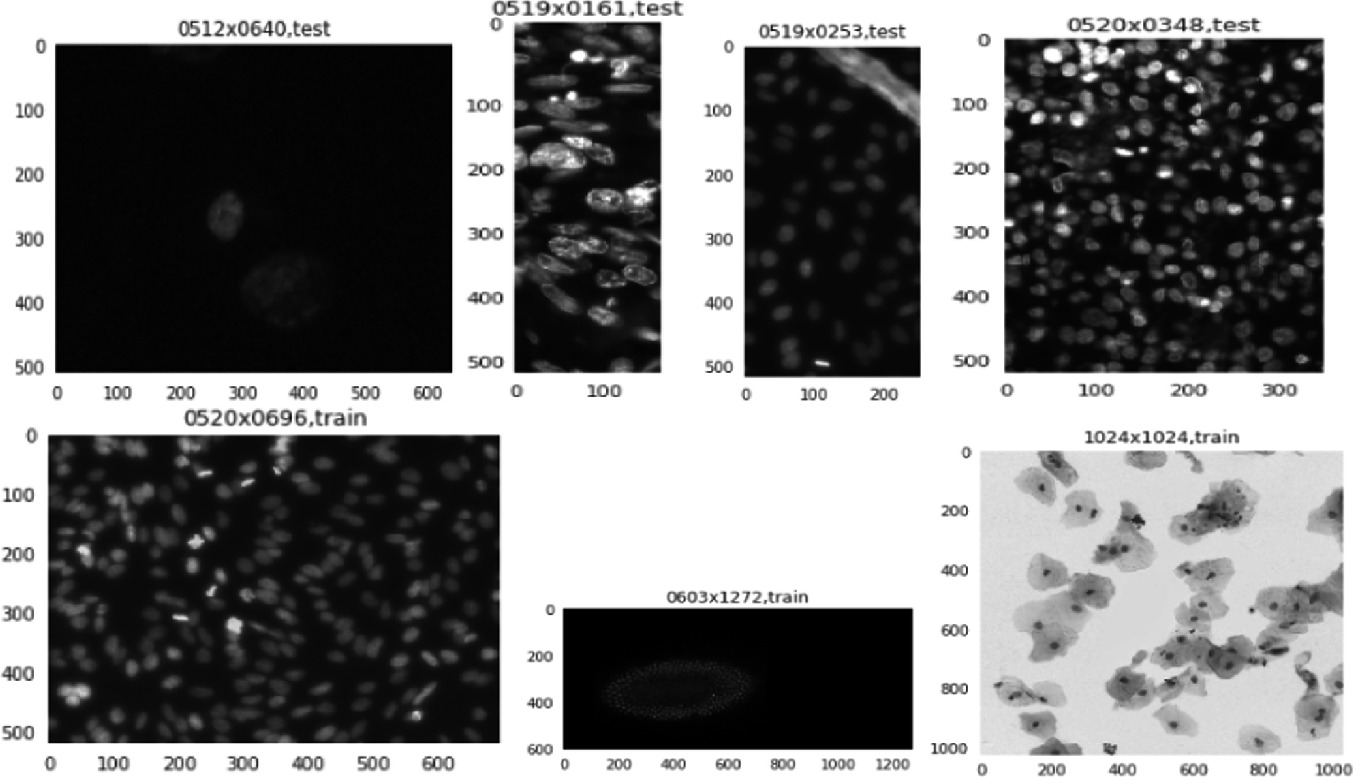 Detecting The Nuclei In Different Pictures Using Region Convolutional Neural Networks Springerlink Detecting The Nuclei In Different Pictures Using Region Convolutional Neural Networks Springerlink
