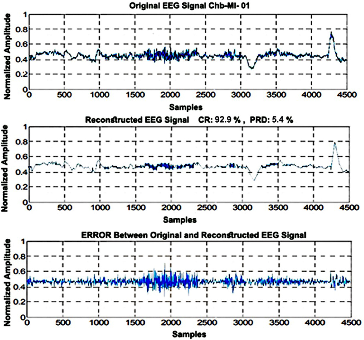 A Tele Encephalopathy Diagnosis Based On Eeg Signal Compression And Encryption Springerlink